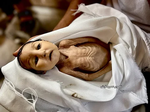 Five month old infant Ghadir Briken who died at Nasser Medical Complex after suffering from severe malnutrition, 22 August 2025.
