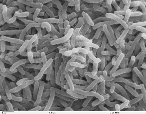 A picture of cholera under a microscope.
