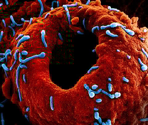 Colorized scanning electron micrograph of Marburg virus particles (blue)