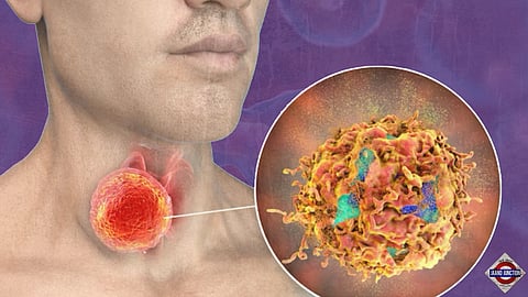 Oral sex found to be leading cause of throat cancer in UK and US, claims study