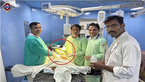 Doctors extract 16-inch bottle gourd from farmer's rectum in Madhya Pradesh