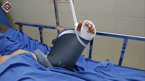 A Plus One student said his hand was broken by seniors in a case of ragging.