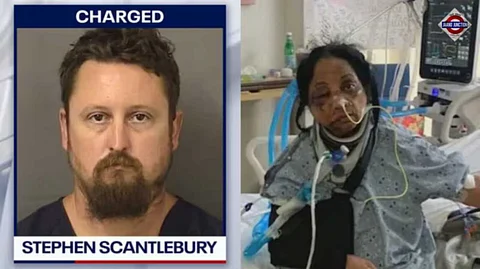 US man brutally assaulted Indian-origin nurse, says "Indians are bad"