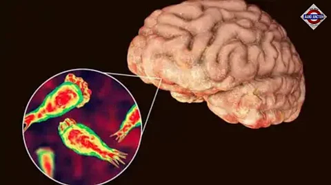 Mumbai on High Alert: Brain-Damaging Tapeworm Cases Surge Amidst Monsoon Chaos