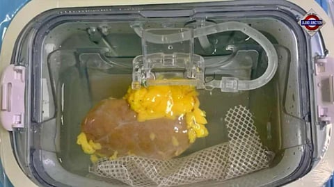 Scientists design universal kidney to match any blood type. Here's how it works