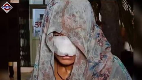 Doctors advised the woman to undergo plastic surgery to reconstruct her face.