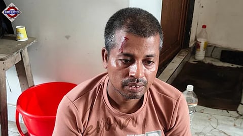 The deceased, Prabash Mondal, was one of the accused in the rape and murder of the minor girl, who had gone missing on July 4.