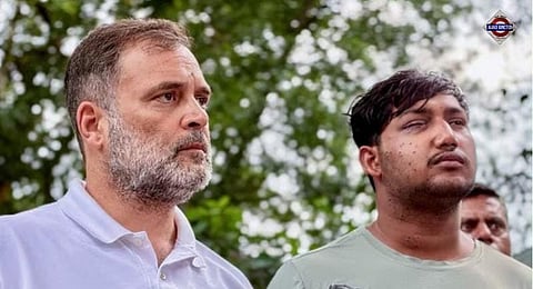 Rahul Gandhi displays a student's injuries while alleging that pellet guns were used during the police action at the Jantar Mantar protest.