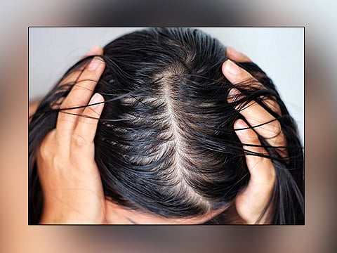 பூனை ரோமம் போயே போச்சு!