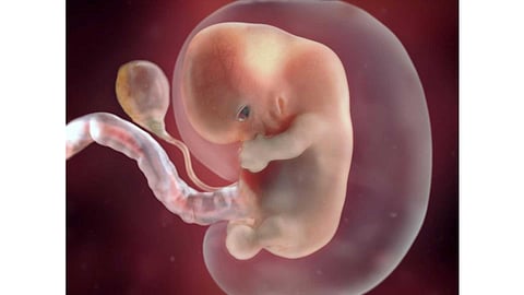 கருக்கலைப்பு