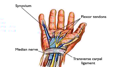 கார்பல் டனல் சிண்ட் ரோம்