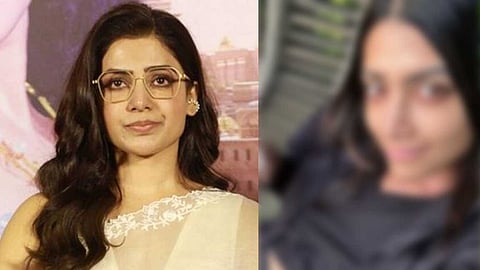 அடுத்த நடிகையைத் தாக்கிய புதிய நோய்!