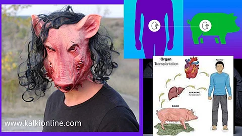 பன்றியின் இதயம் மனிதனுக்குப் பொறுந்துமா?