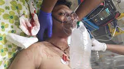 காத்தாடி மாஞ்சா நூல் கழுத்தை அறுத்து ஒருவர் தீவிர சிகிச்சை பிரிவில்; மற்றொருவர் படுகாயம்!