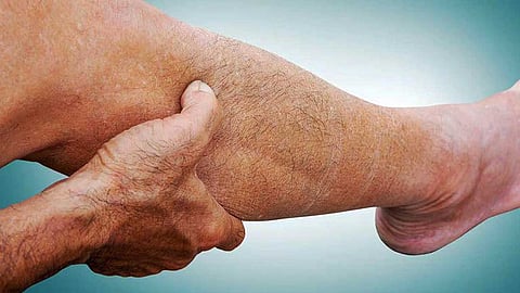 கோடையில் வாட்டும் தசைப்பிடிப்பும் (Cramps) தீர்வுகளும்