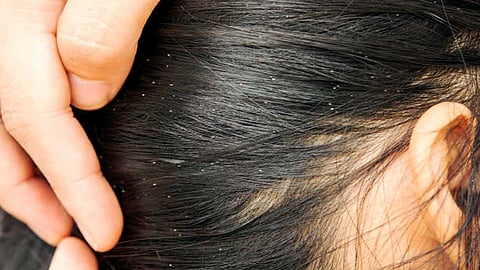 உருவமோ சிறியது; தொல்லையோ பெரிது!