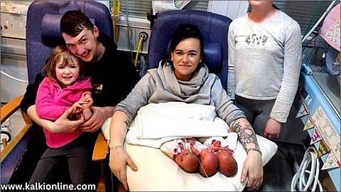 ஒரே உருவத்தில் மூன்று குழந்தைகள் - 200 மில்லியனில் ஒருவருக்கு நடக்கும் அதிசயம்.