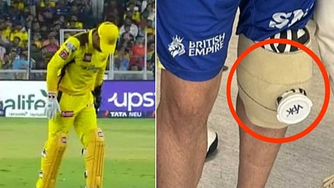 தோனிக்கு அறுவை சிகிச்சையா!?