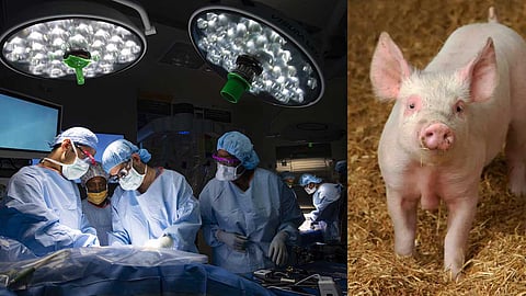 மனிதருக்கு பொருத்தப்பட்ட பன்றியின் சிறுநீரகம் : மருத்துவ உலகில் புதிய மைக்கல்!