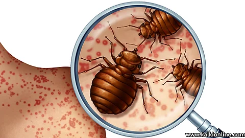 What to do if bitten by a bed bug?