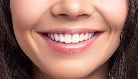 White teeth
