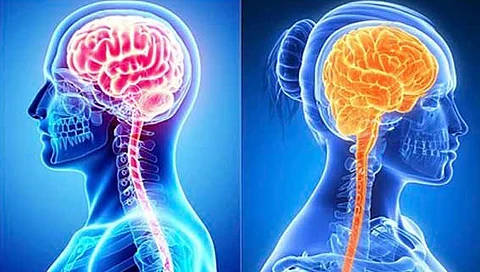 brain affect habits