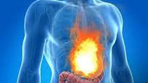 What can be done for heartburn caused by indigestion?