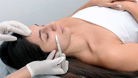 Dermaplaning