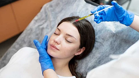 Micro needling