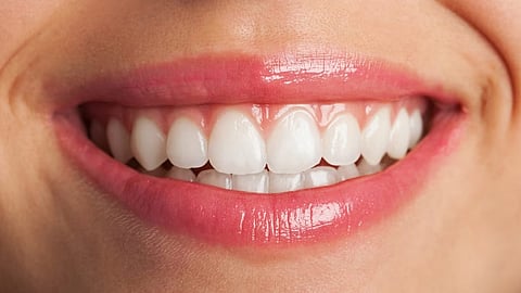 Gums speak the beauty of teeth