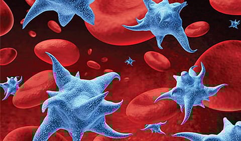 Foods to Eat When Platelet Count is Low