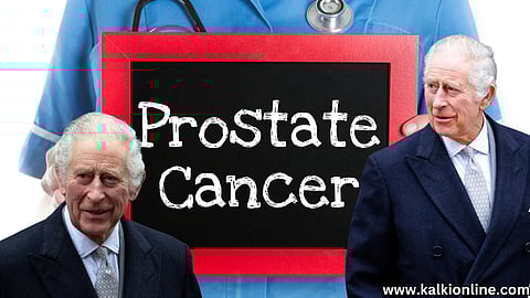 Prostate Cancer in tamil