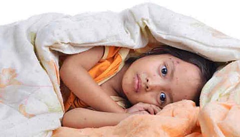 Summer heat and measles