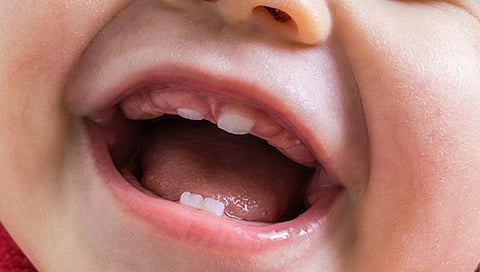 Baby's milk teeth and care