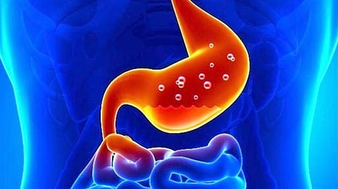 Don't take it for granted that flatulence is just a nuisance