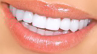 Foods that protect teeth health