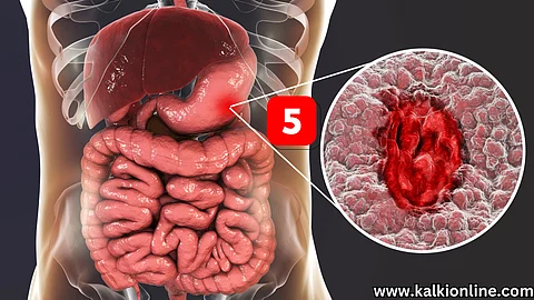 Ulcer can form if you have these 5 habits!