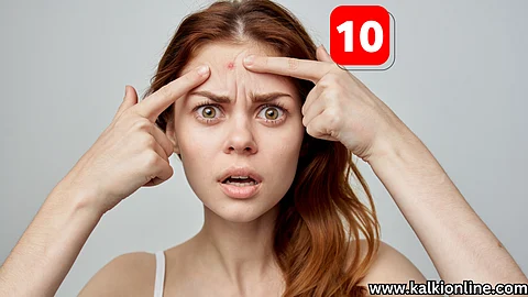 10 tips to prevent acne in summer!