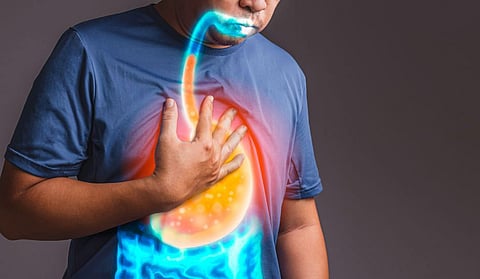 Do you know what is 'GERD'?