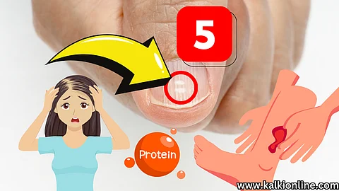 5 signs that the body is low in protein.