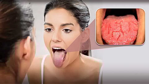 Woman examining tongue