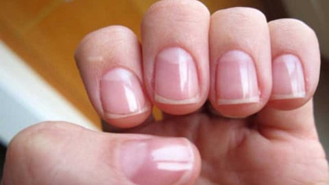 Nail Health