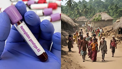 Hemoglobin Blood test for hill villagers