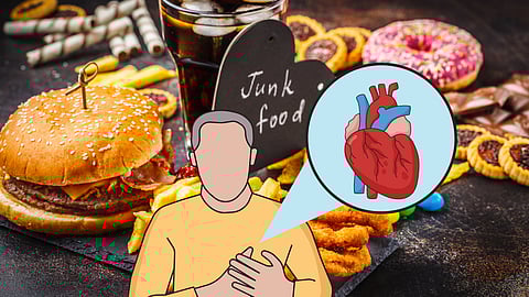 Junk Foods