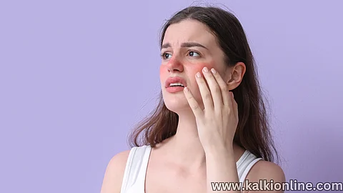 Face Redness