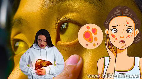 Symptoms of Liver Problems