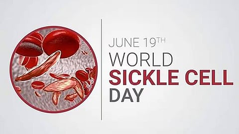 World Sickle Cell Day