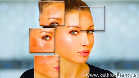 Simple ways to remove dark spots on forehead!