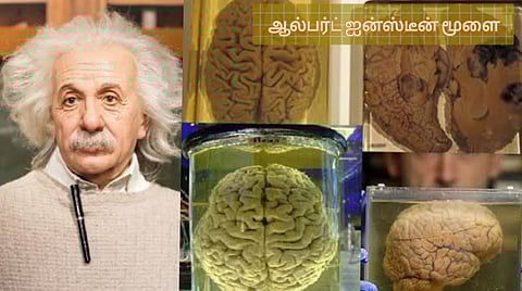 Albert Einstein Brain