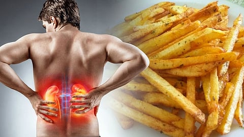 Foods that affect the kidneys